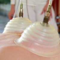 Pneumatische Pulsationsmassage: Massage auf Basis eines pulsierenden Vakuums